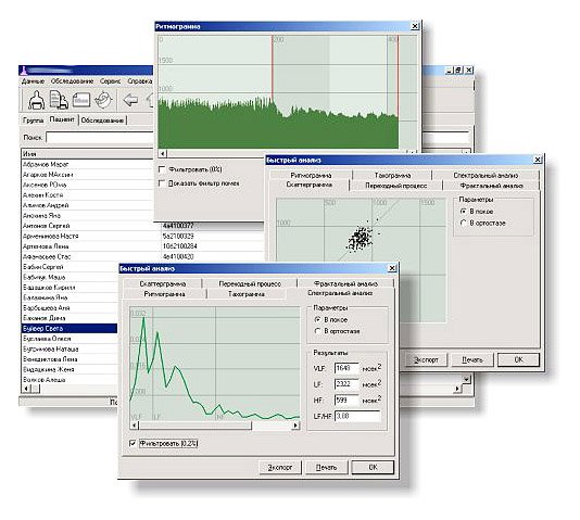 Biotechnology startup - development of wireless heart rate monitor