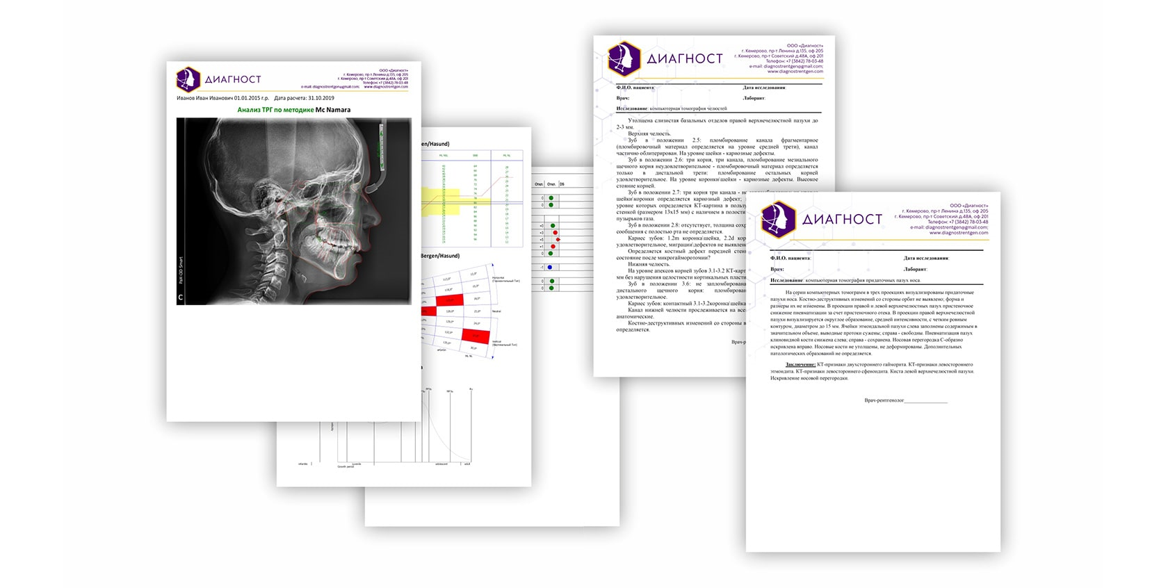 Detailed description: TRG analysis, 3D CEPH analysis